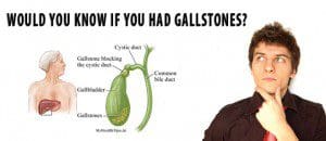 Would you know if you had gallstones?