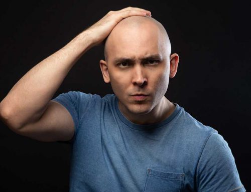 Male Baldness Linked To Prostate Cancer