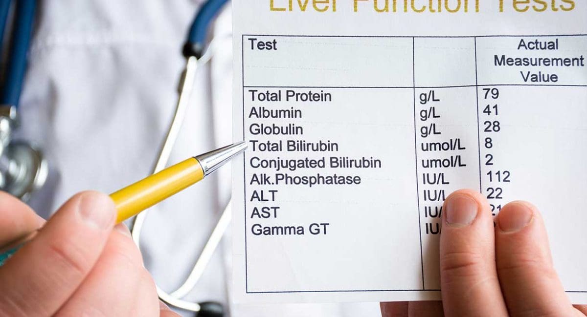 How To Read Your Liver Blood Tests Cabot Health