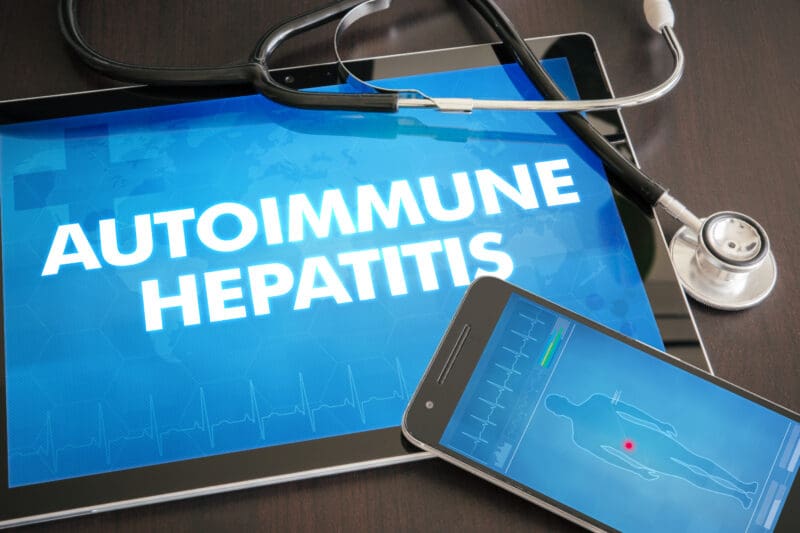 Autoimmune hepatitis When the immune system attacks the liver Cabot