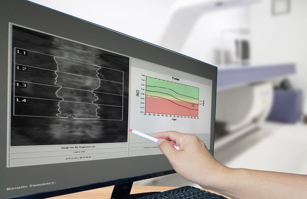 Your bone scan may reveal more than just fracture risk